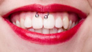 The Oral Health Risks of Tongue and Lip Piercings